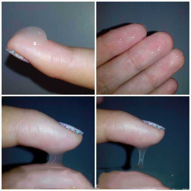 Nó trông như thế nào